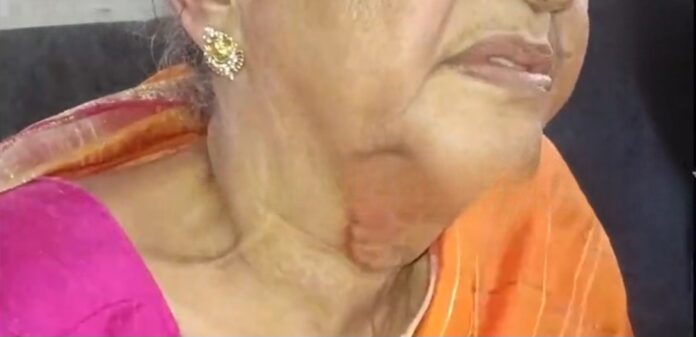 ಬೆಳಗಾವಿ ನಗರದಲ್ಲಿ ವೃದ್ಧೆಯ ಸರಗಳ್ಳತನ