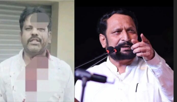 ಬೆಳಗಾವಿ : ಅಥಣಿ ಶಾಸಕ ಲಕ್ಷ್ಮಣ ಸವದಿ ವಿರುದ್ಧ ಮಾರಣಾಂತಿಕ ಹಲ್ಲೆ ಆರೋಪ